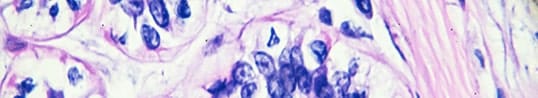 homepage_immunology-2x-min