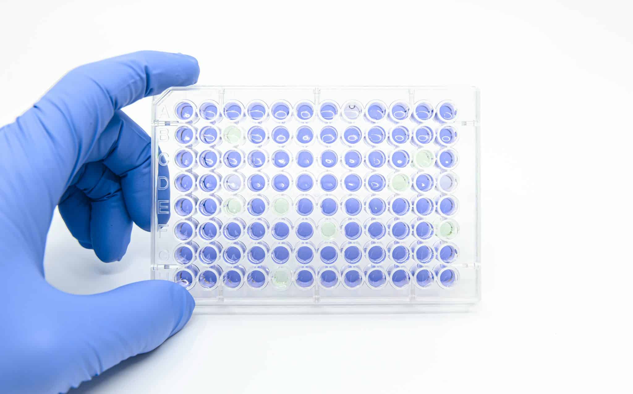 Scientist is holding 96 well micro plate that tested enzyme linked immunosorbent assay(ELISA) for drug screening in laboratory