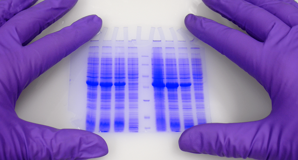 Electrophoresis Overview